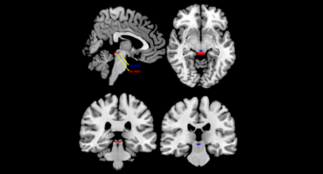 Brain scans