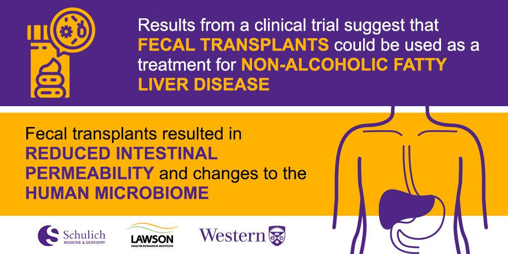 Fecal transplant graphic